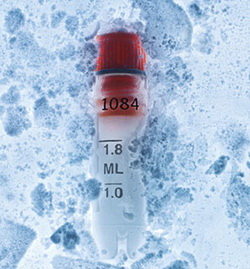 Types of Sperm Banks